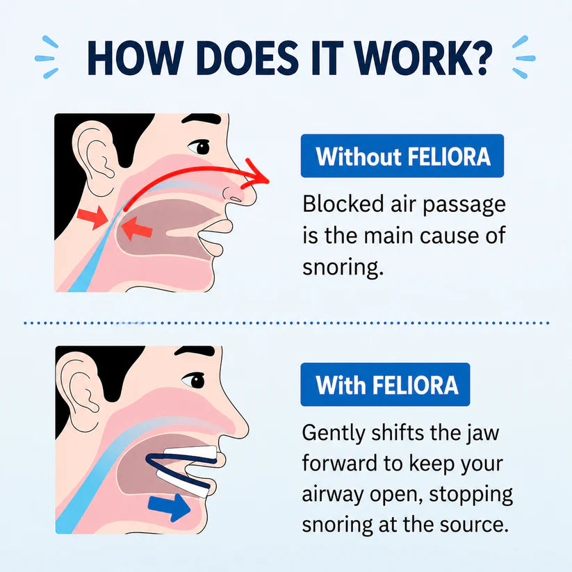 Feliora Anti-Snoring Mouthpiece